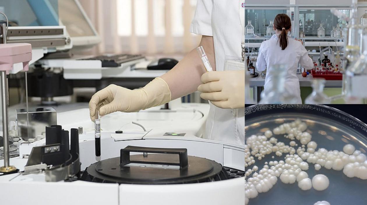 La diferencia del Candida auris frente a otros hongos es que es más virulento, lo que significa que es más resistente y dañino para las personas. 