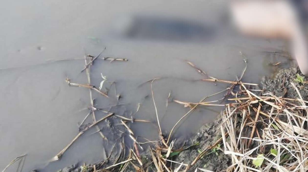 Imagen del cuerpo de la mujer.