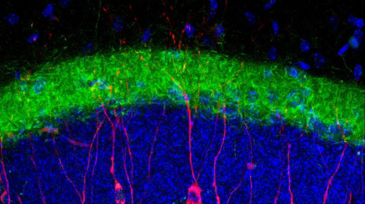 Tinción de marcadores neuronales estudiados en el del hipocampo de un ratón macho adulto. 