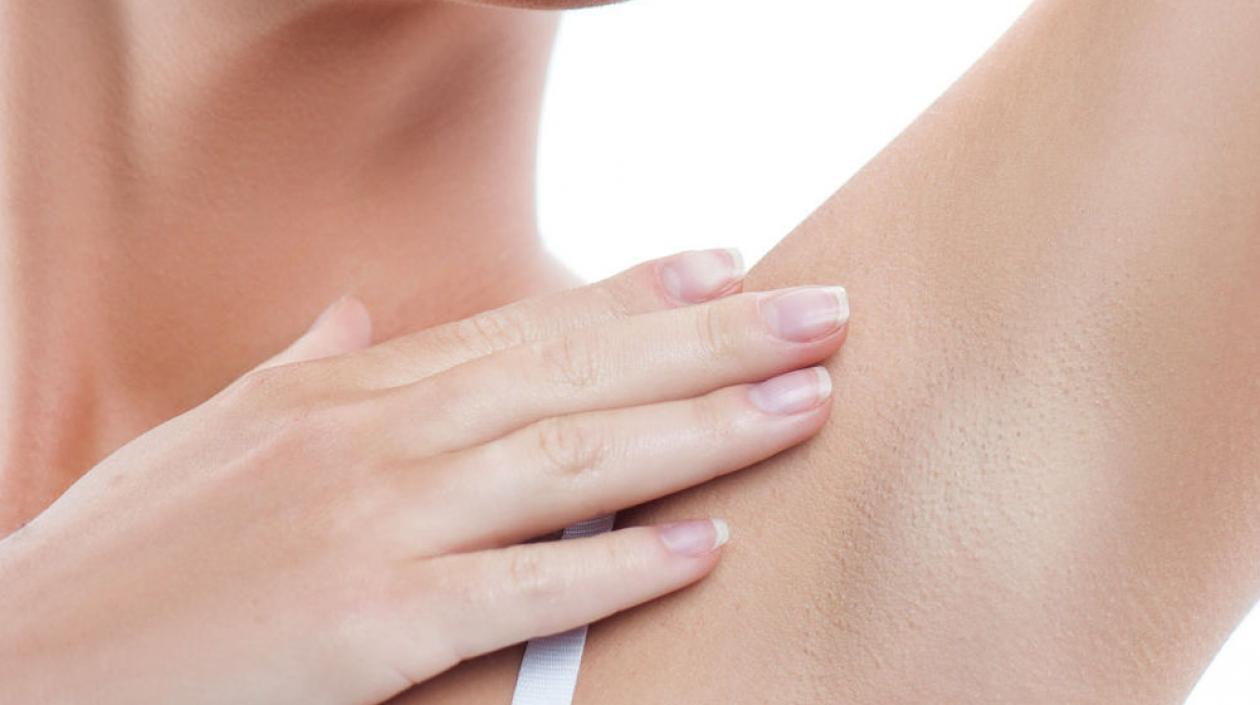 "La hidradenitis supurativa es una enfermedad inflamatoria. Son los llamados golondrinos.