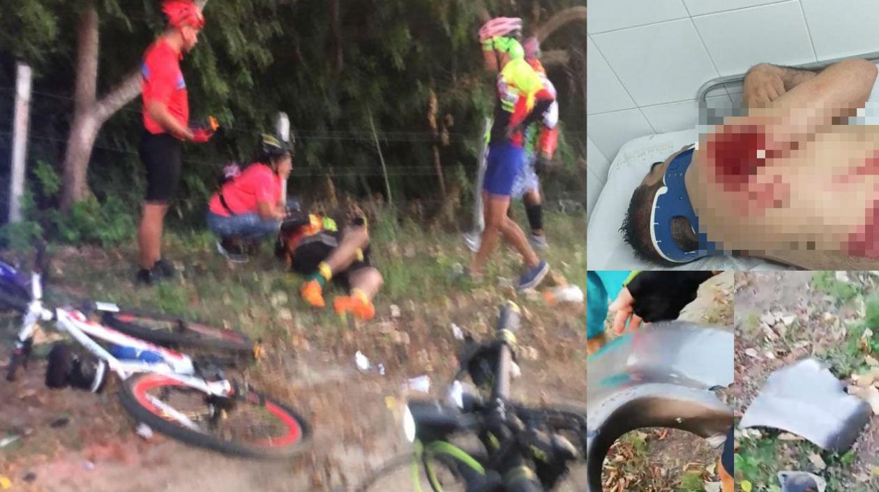 Fotografía del accidente de Guillermo Sánchez Gómez, que fue arrollado por una camioneta esta mañana en la vía al Mar.