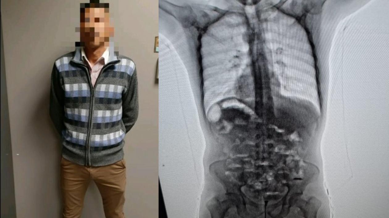 El capturado y la droga en su cuerpo.