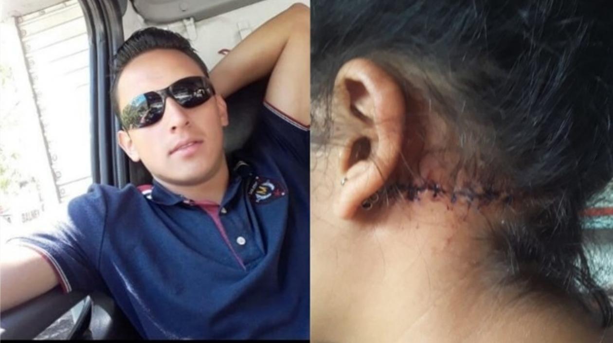  Edward Alexánder Porras Bohórquez agredió brutalmente a su exnovia.