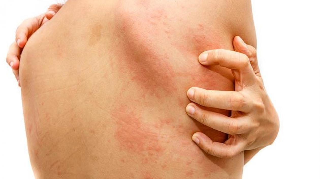 Quienes acudan a la jornada recibirán el diagnóstico y orientación gratis.