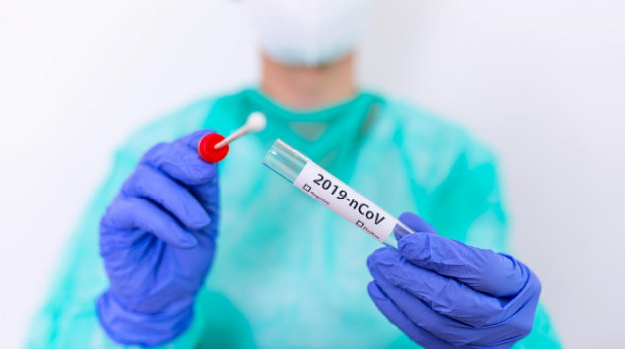 Pruebas de Covid-19.