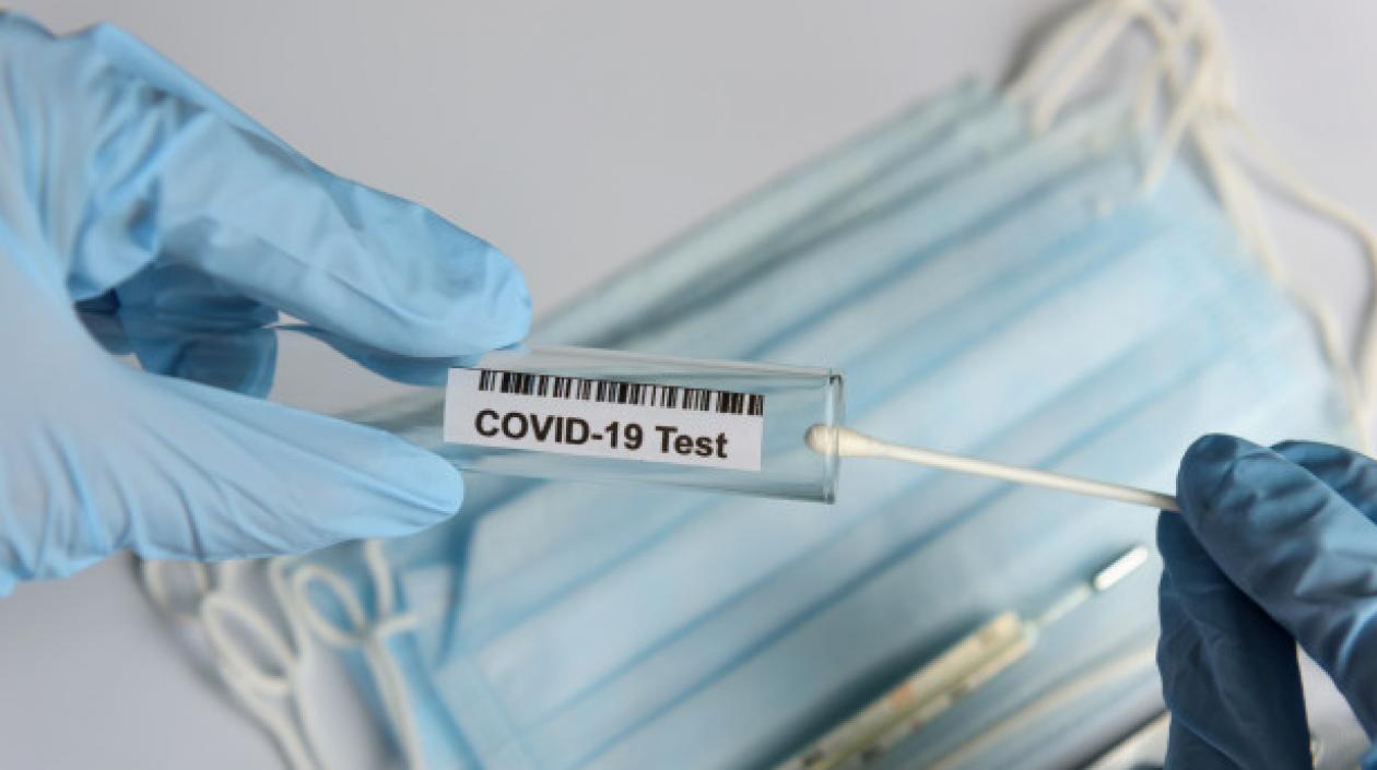 Las pruebas de Covid-19 siguen en Colombia.