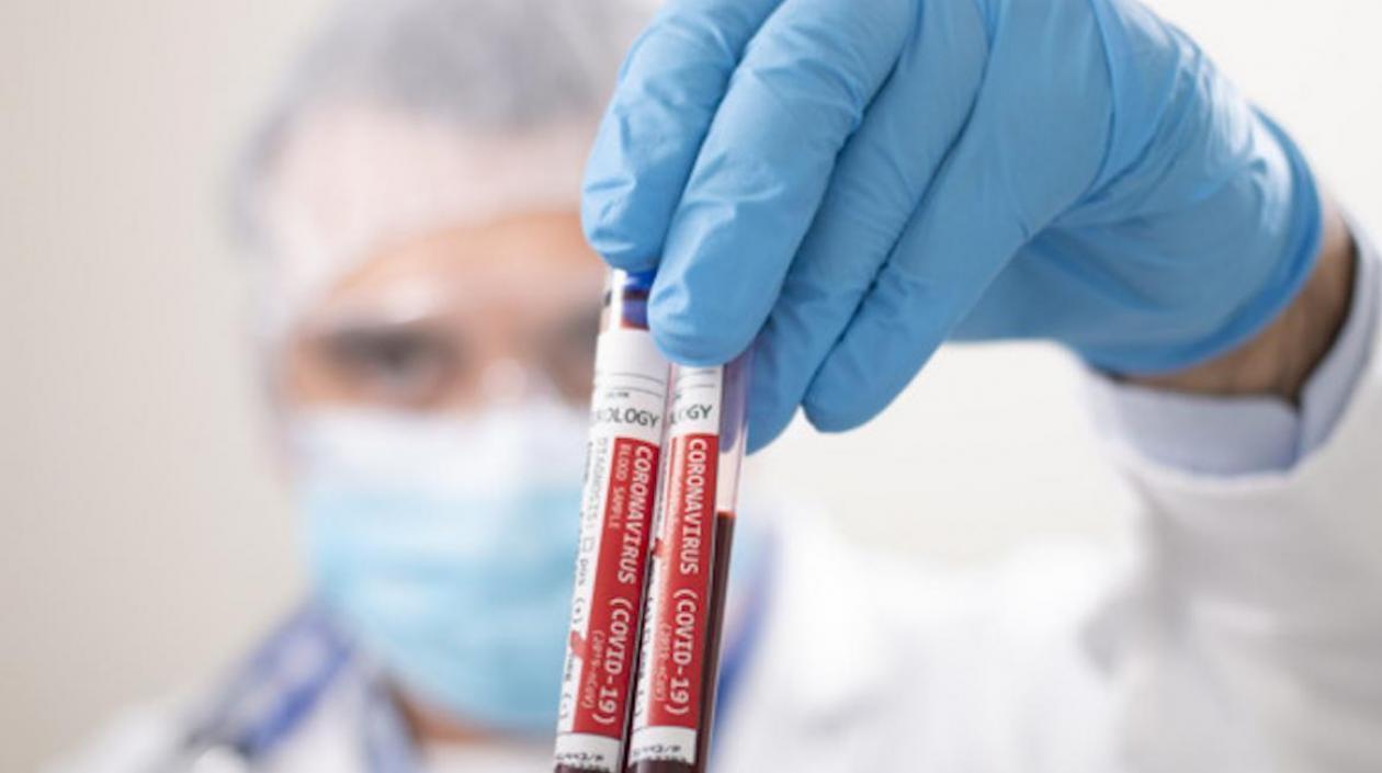 Pruebas siguen haciéndose en busca de casos de coronavirus.