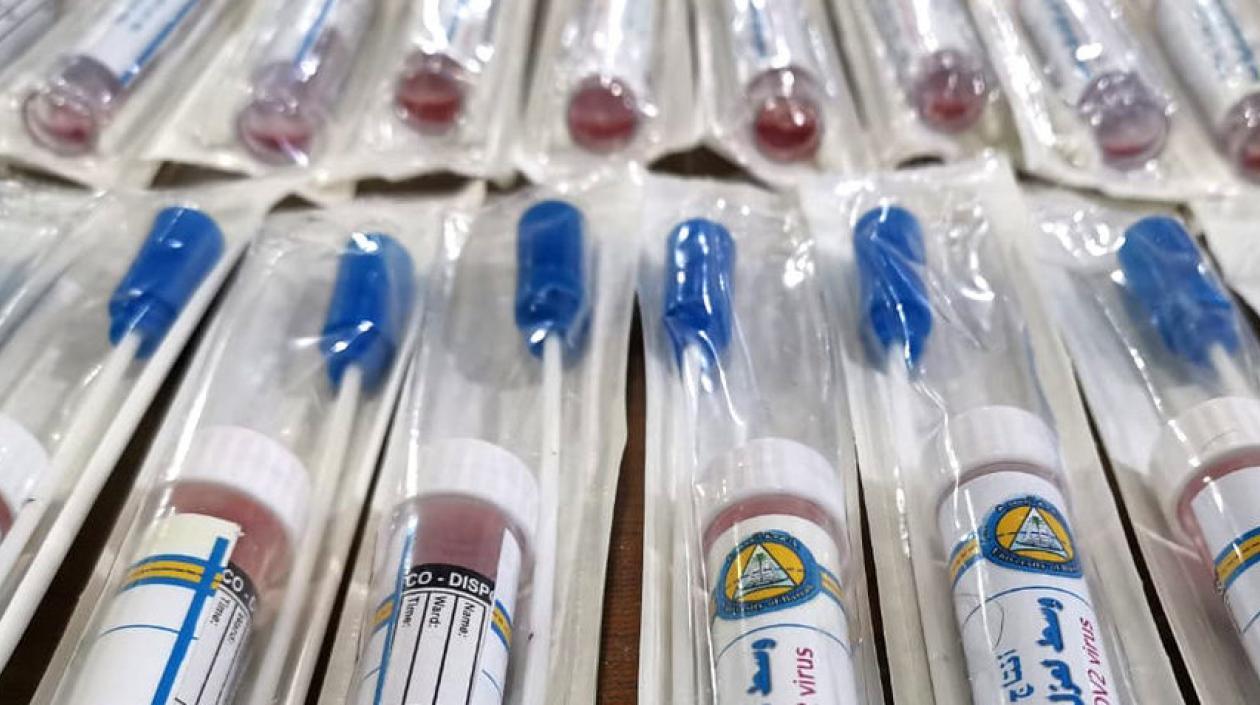 El país realizó más de 7 mil pruebas de coronavirus para detectar nuevos contagios.