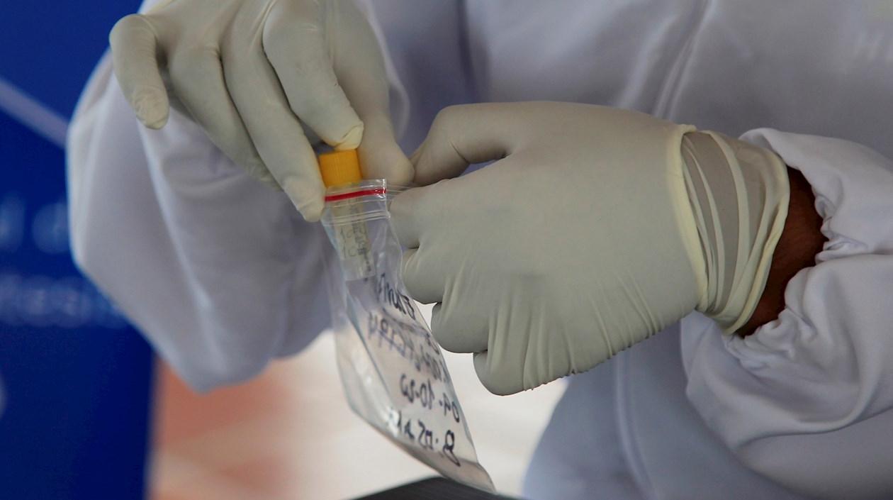 Un trabajador de la salud alista una prueba Covid-19 para procesarla.