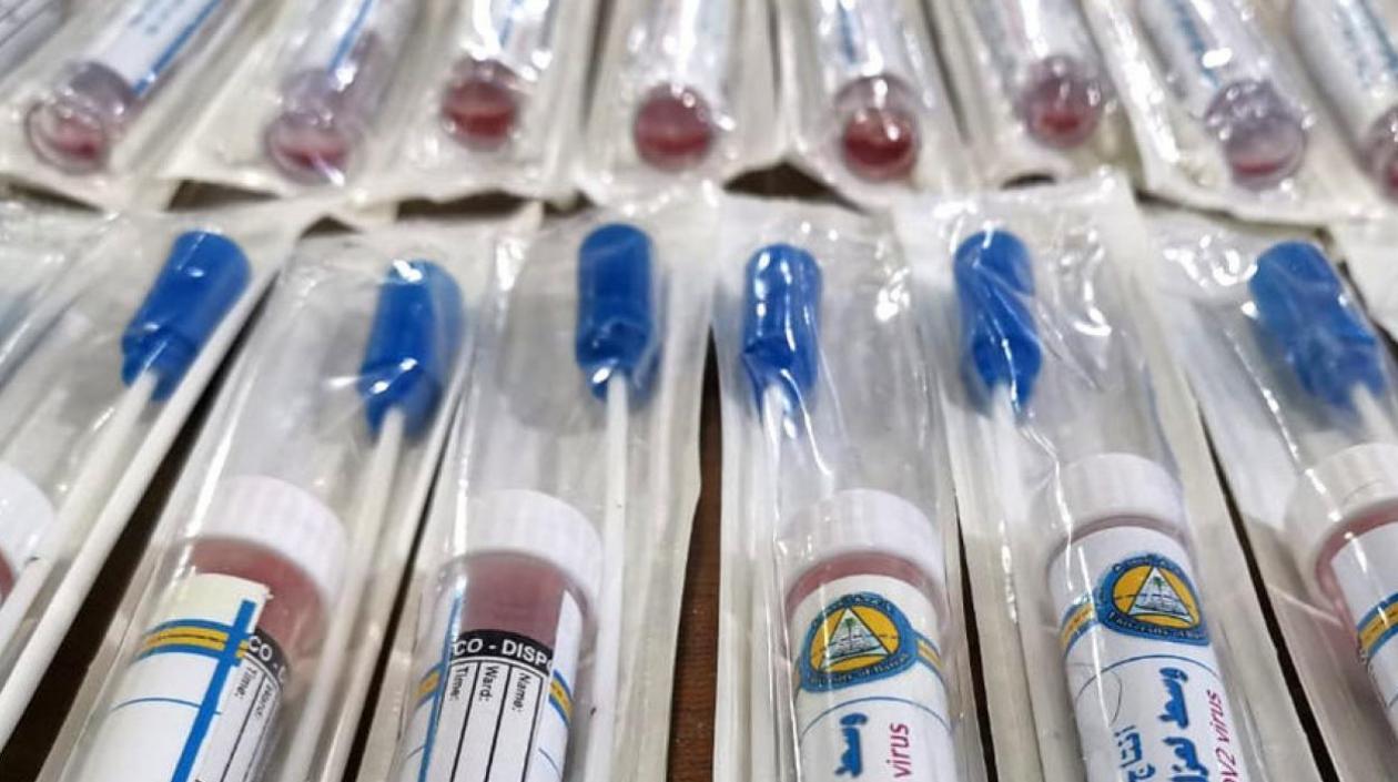 Muestras para Covid-19.