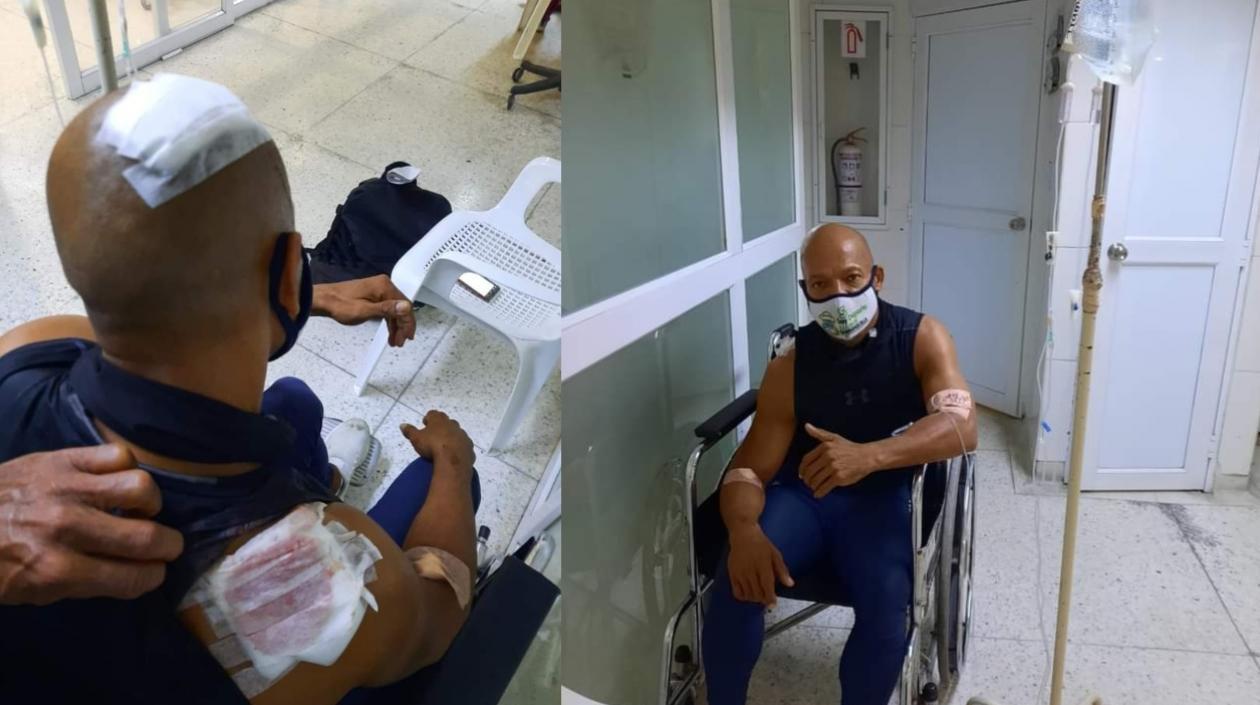 Celiar Beleño, instructor de gimnasio, resultó herido en medio del atraco. 