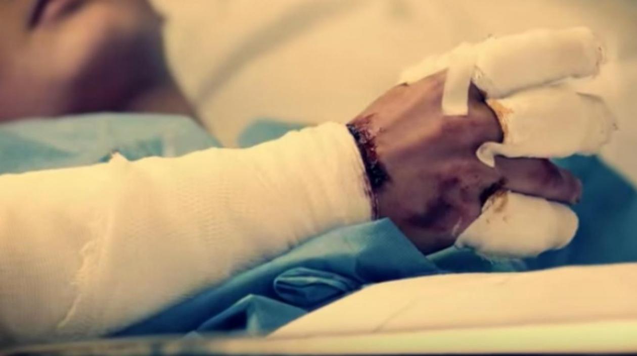 Antioquia sigue siendo el departamento con más casos de lesionados por uso de pólvora.