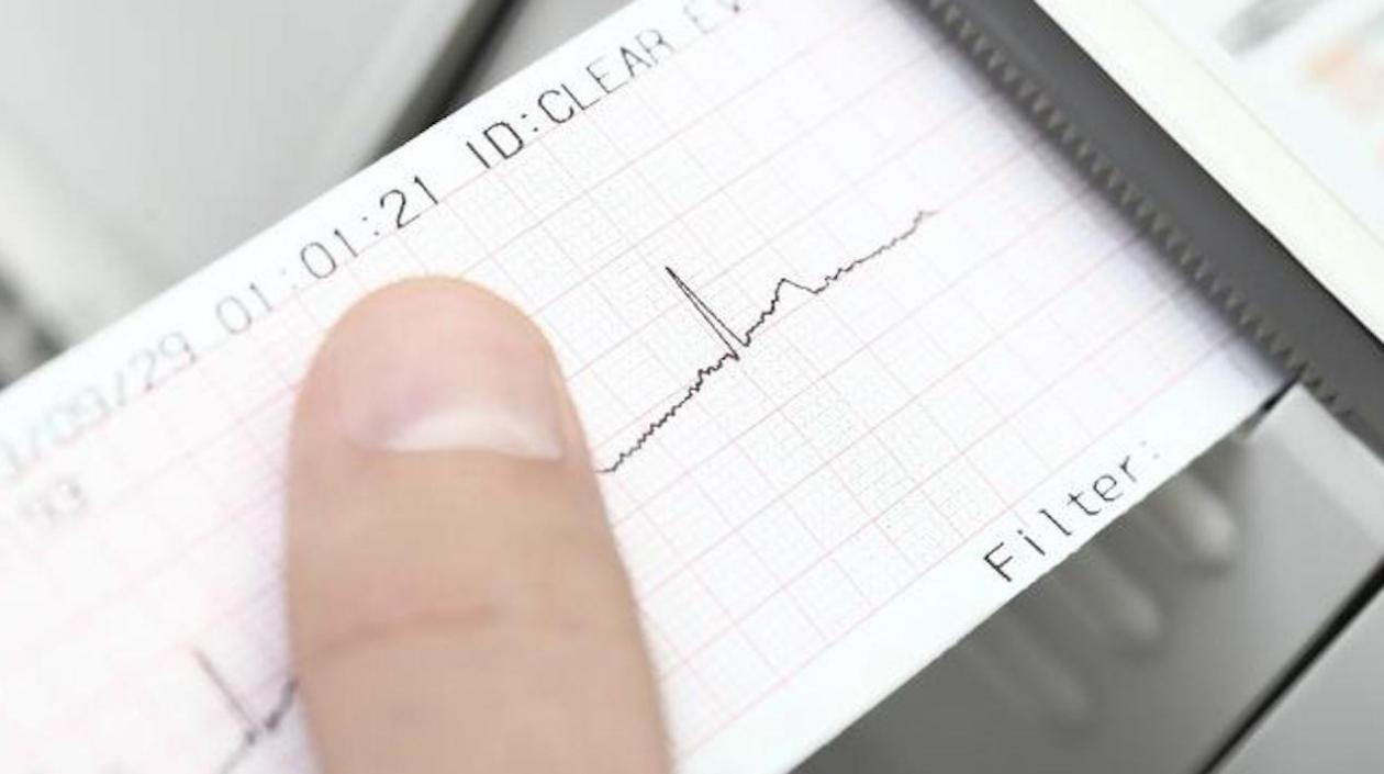 Electrocardiograma.