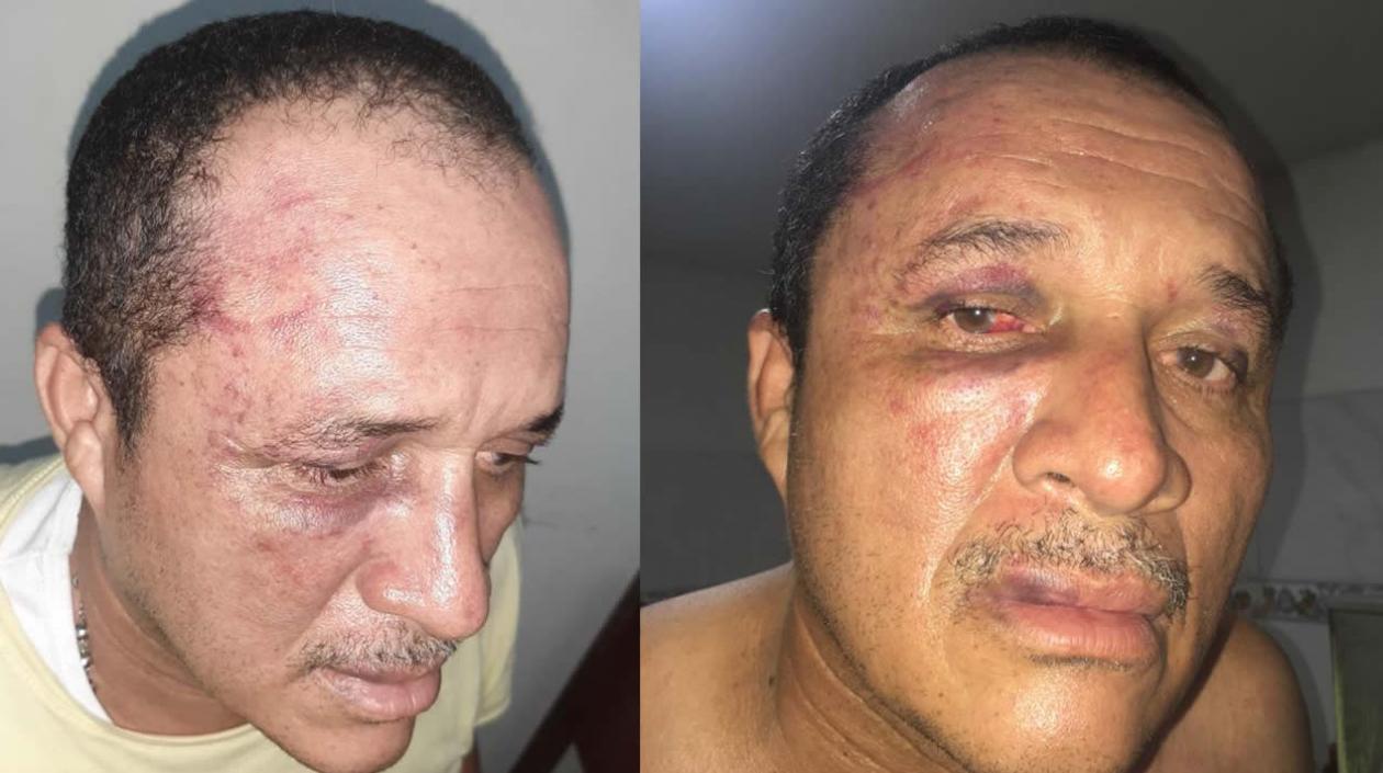 Así quedó el taxista tras la agresión.