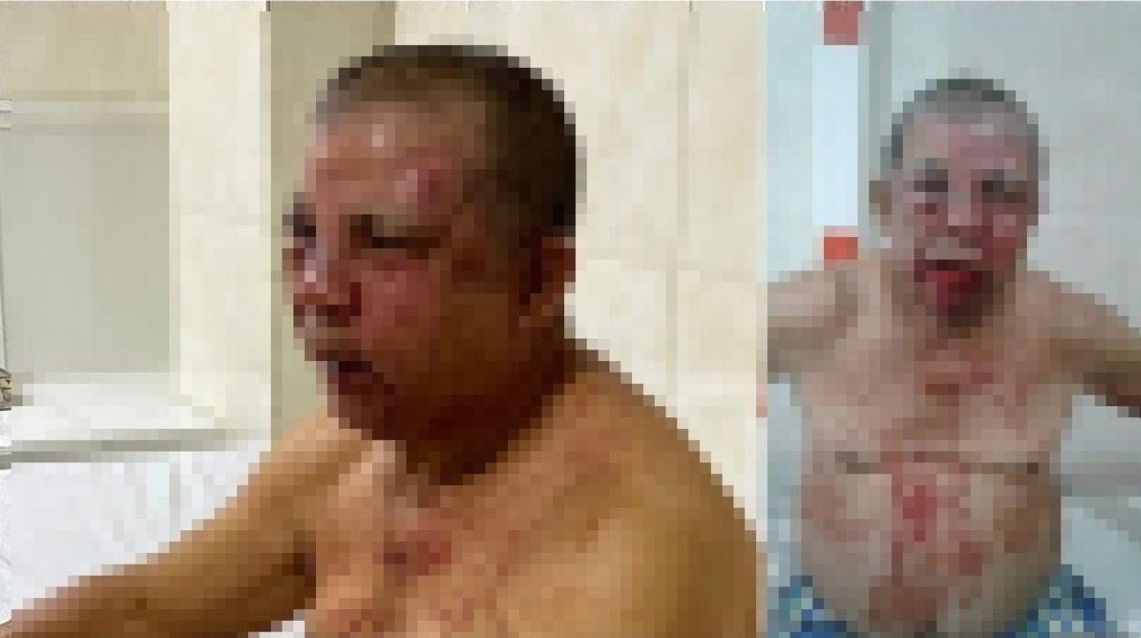 Con golpes en su cara quedó el comerciante Dagoberto Sierra en Luruaco.