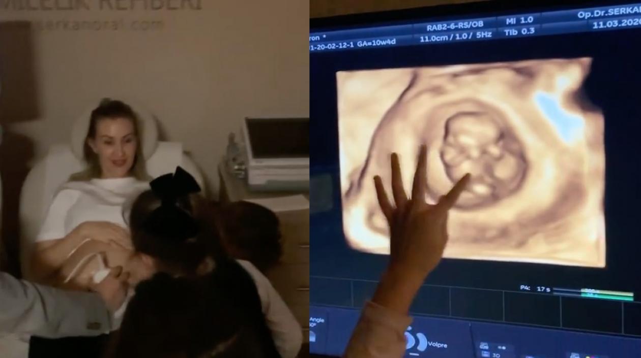 Momentos en que se le realiza una ecografía a Lorelei Tarón, esposa de Falcao García.