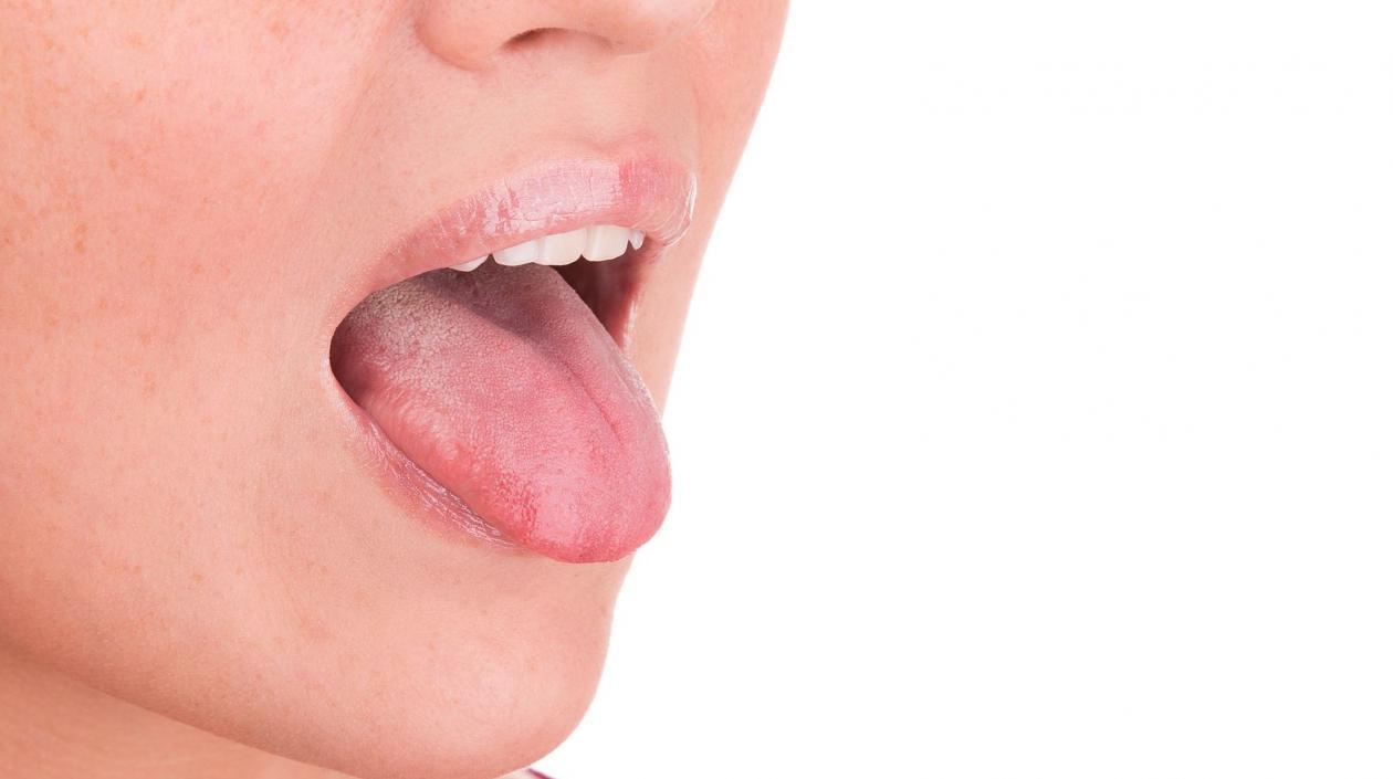 Investigadores  usaron pequeñas muestras obtenidas de las lenguas de 21 participantes.