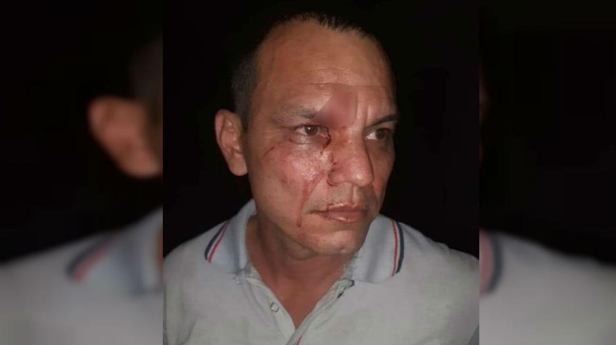 El Concejal de Algarrobo, Jaider Isaza Gutiérrez