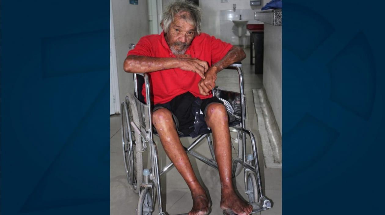 El adulto mayor fue llevado al Hospital Juan Domínguez Romero de Soledad.