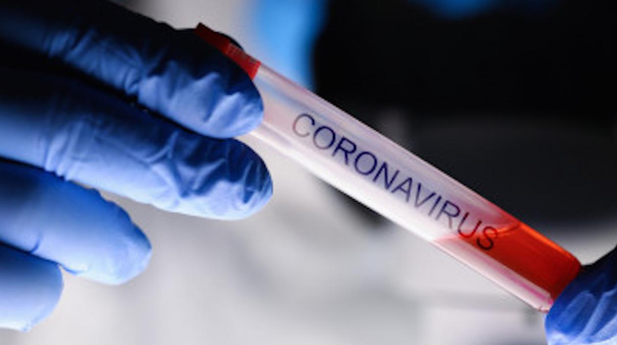 Hoy se reportaron 81 nuevos casos.