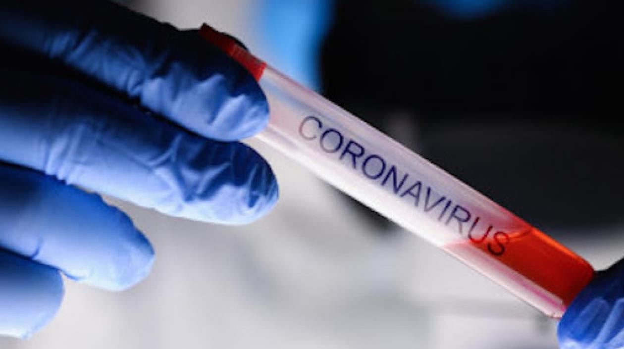 Casos en el país aumentaron.