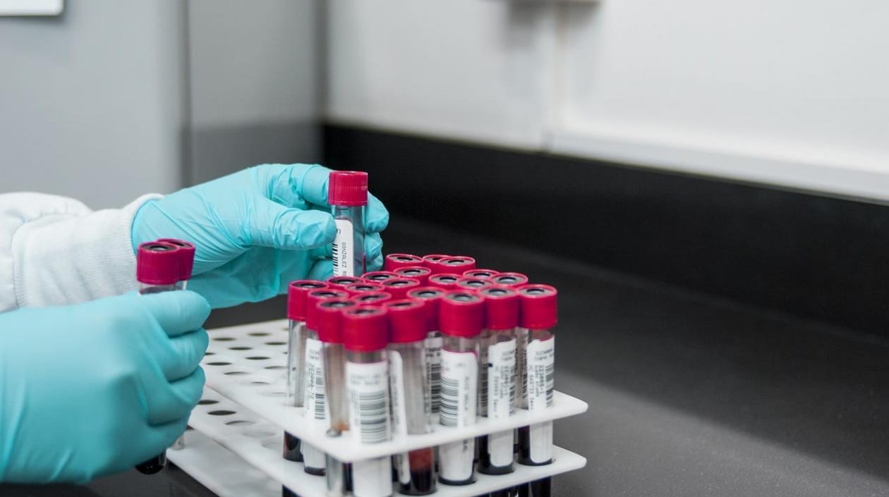 Hoy se realizaron más de seis mil pruebas diagnósticas de coronavirus.