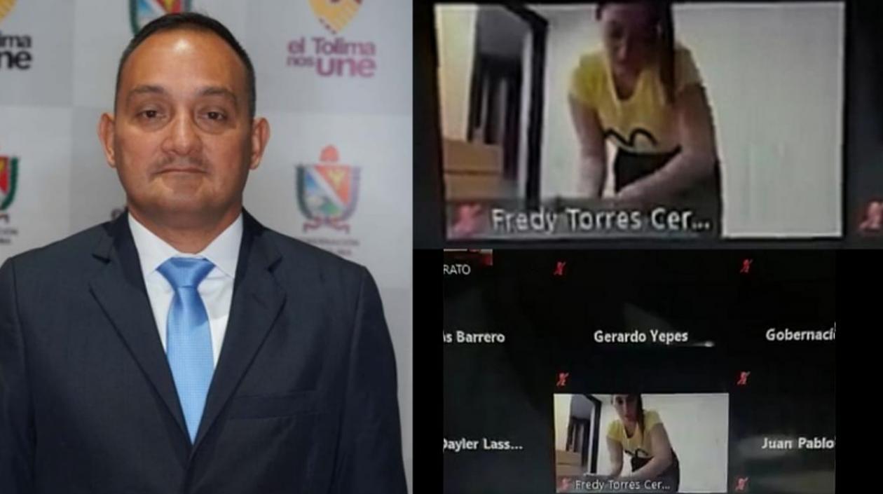 Fredy Torres Cerquera y la depilación en plena sesión.