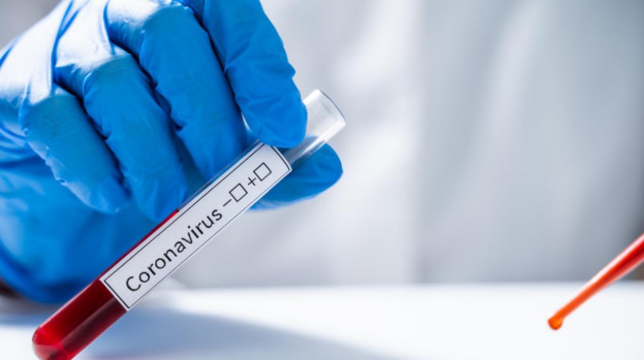 Pruebas de Covid-19 sigue haciéndose en el departamento del Atlántico.