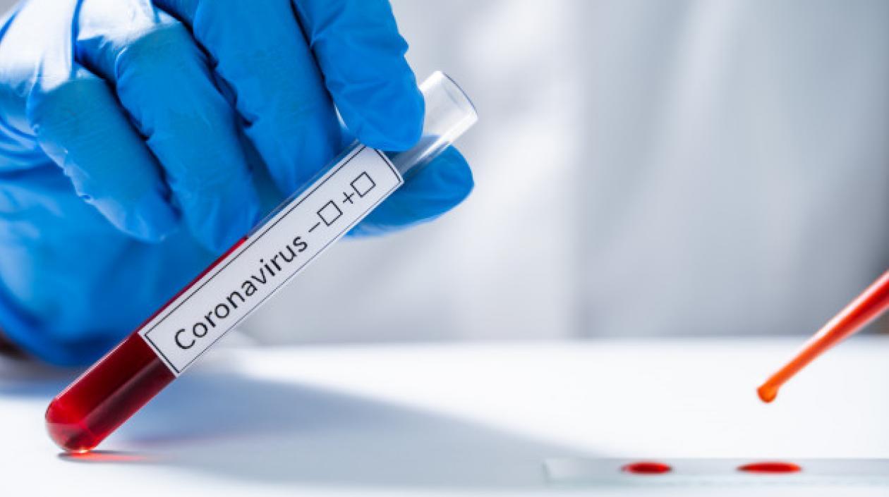 Entidad está preocupada por pruebas a afiliados de las EPS.