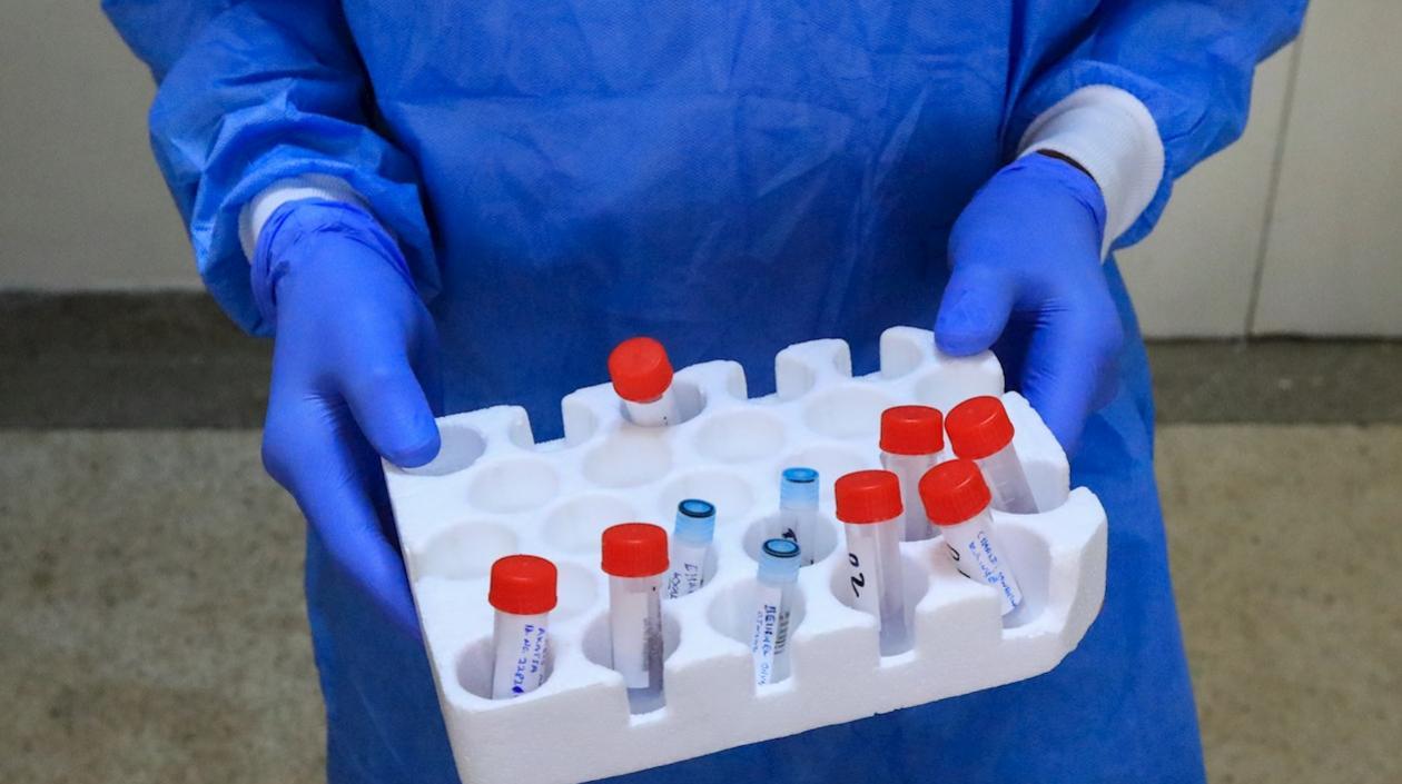 Más de la mitad de los países de África están experimentando la transmisión comunitaria de la Covid-19.