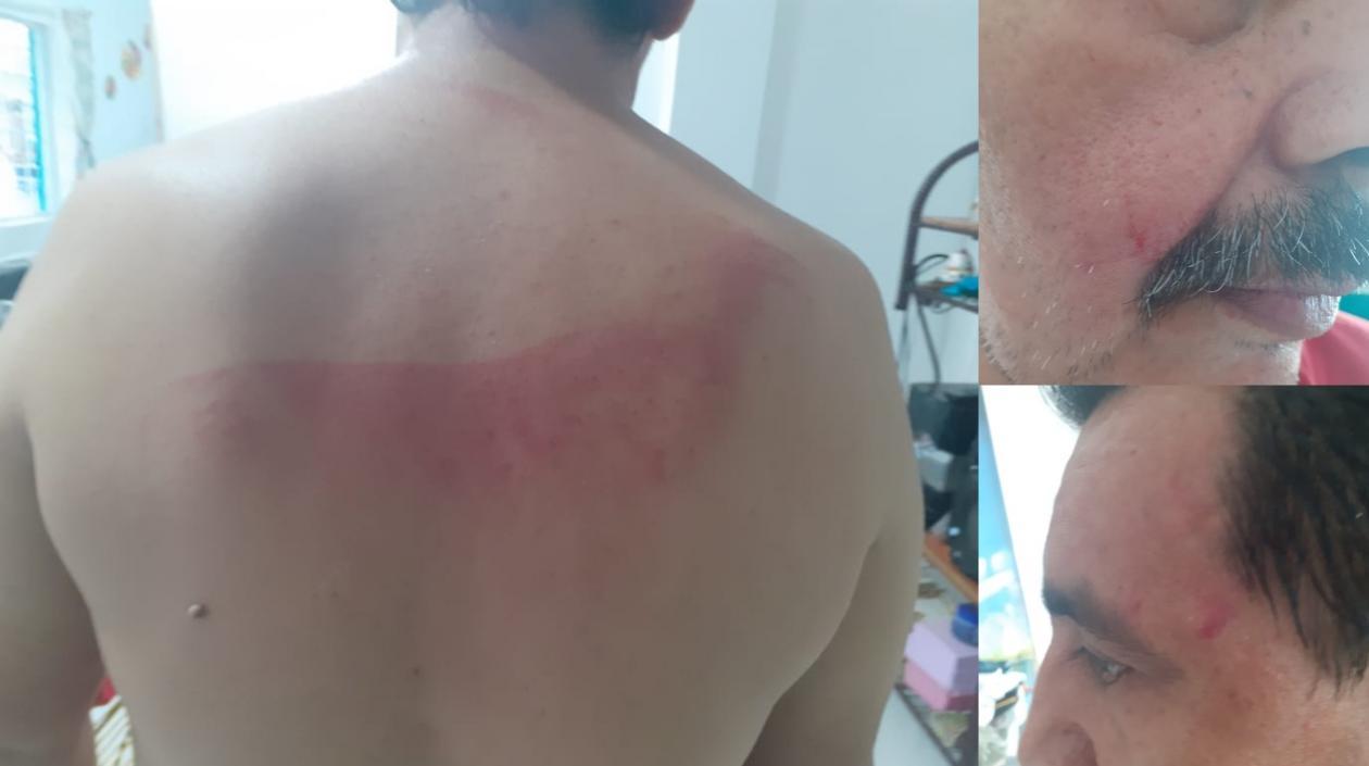 Agresión a uno de los hombres.