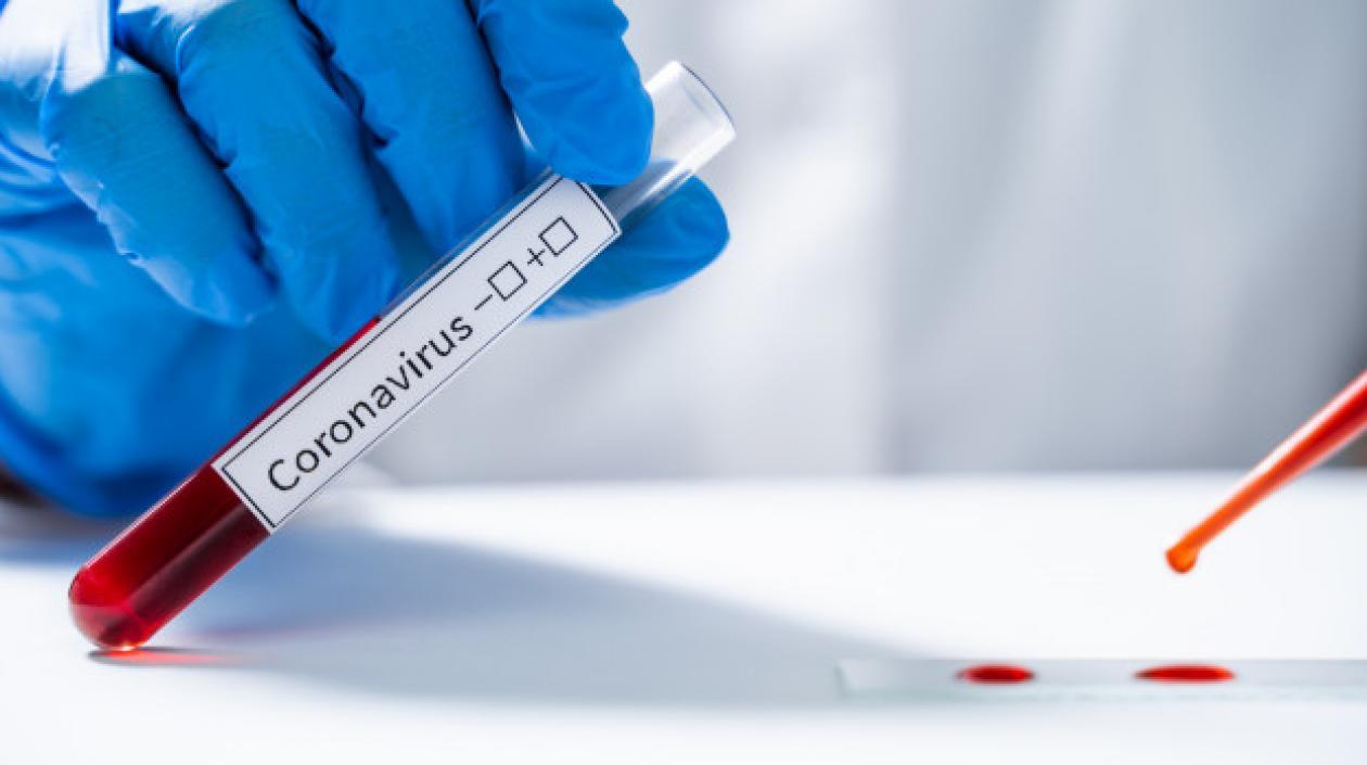 El coronavirus sigue cobrando víctimas en Atlántico.