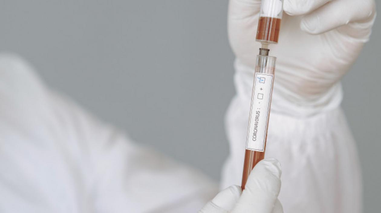 Los casos mortales comenzaron a bajar en Barranquilla.