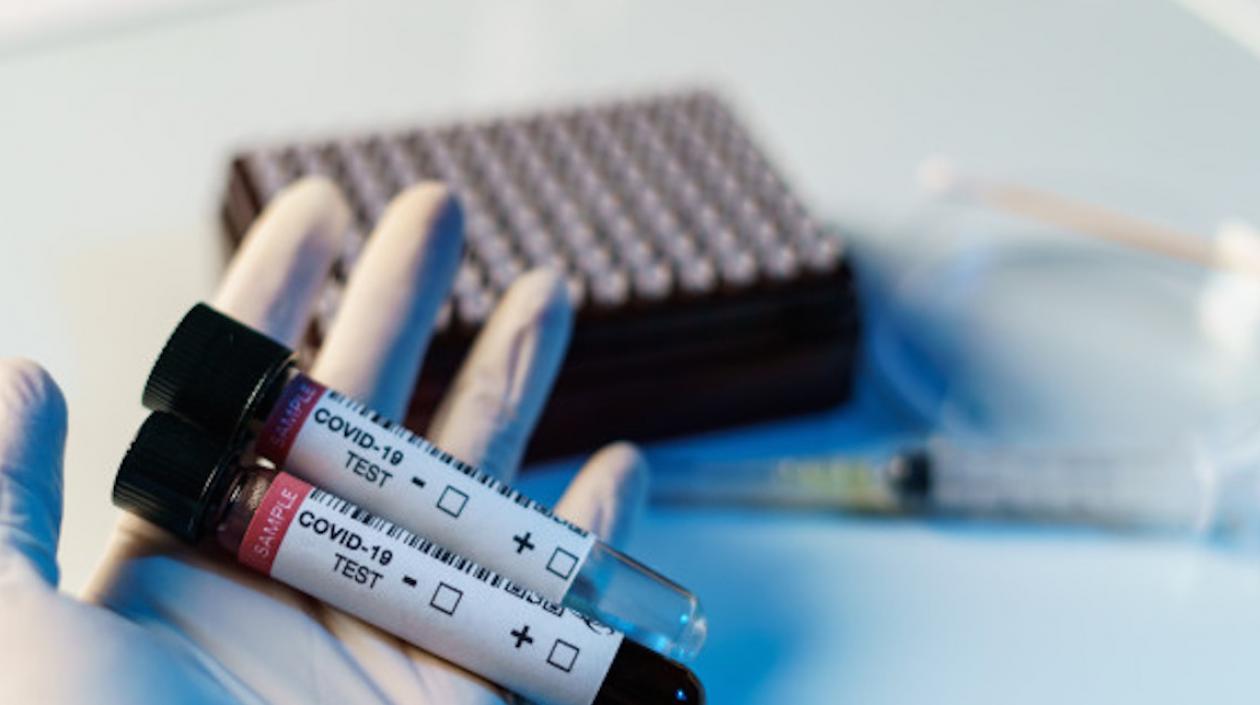 Sigue en alza en el país el coronavirus.