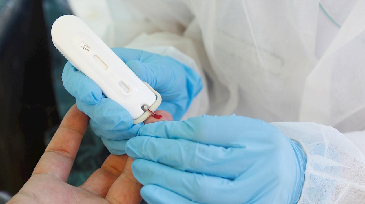   Las Américas suman 9,47 millones de casos.