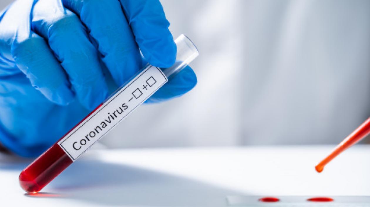 Imagen de referencia para ilustrar la nota.