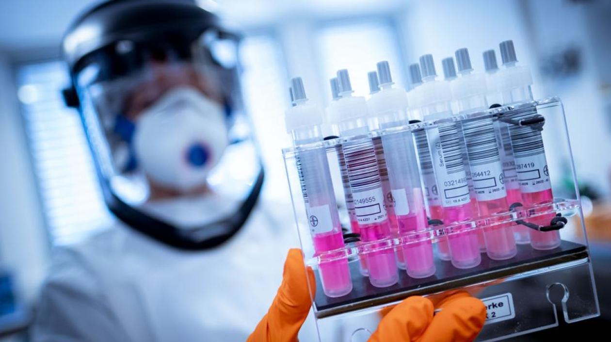 La comunidad científica baraja dos hipótesis fundamentales para explicar el daño multiorgánico en los pacientes más graves de Covid-19. 