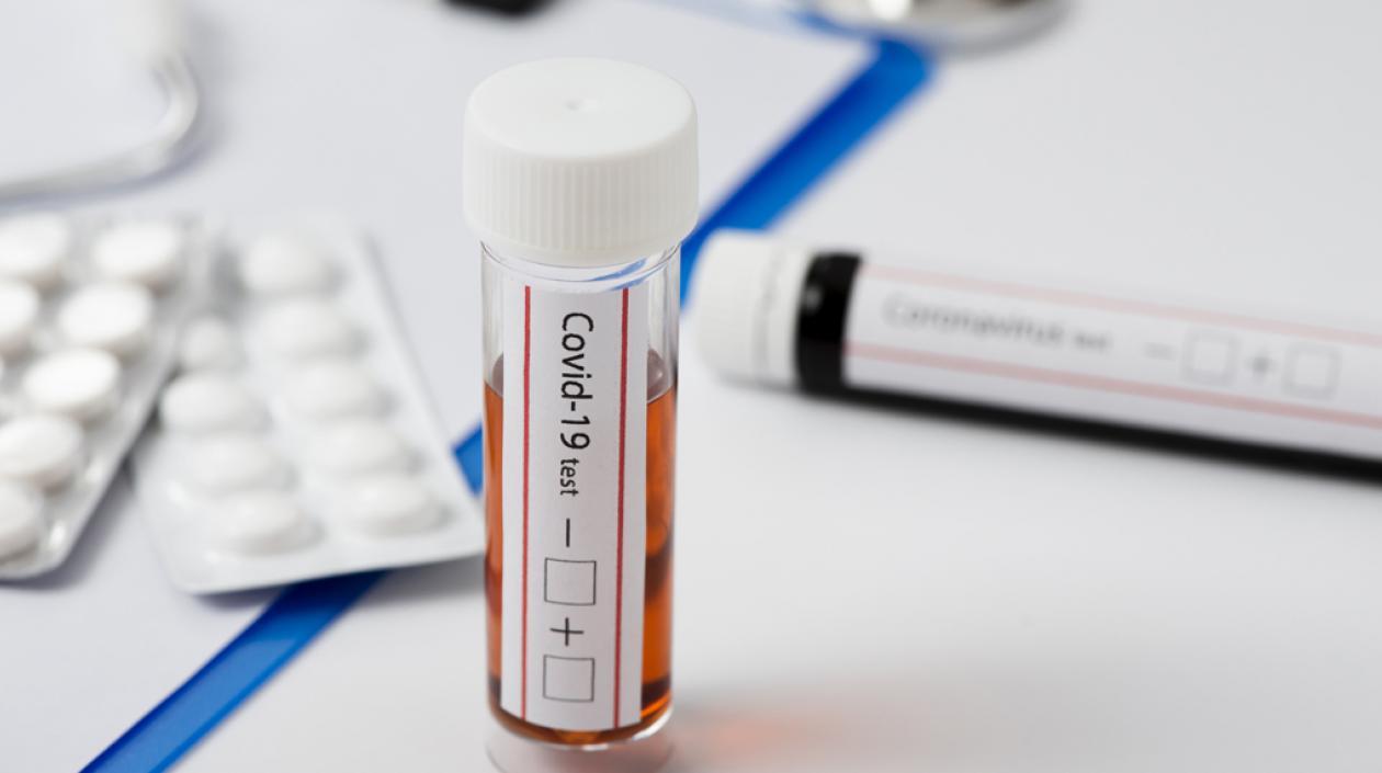 Coronavirus comienza a bajar en algunas ciudades de Colombia.