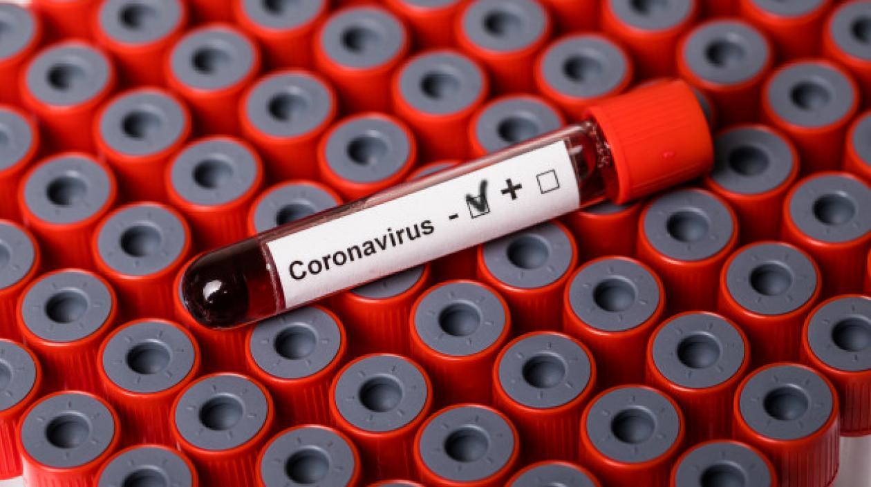 Casos en Atlántico bajan en cuanto al reporte diario.