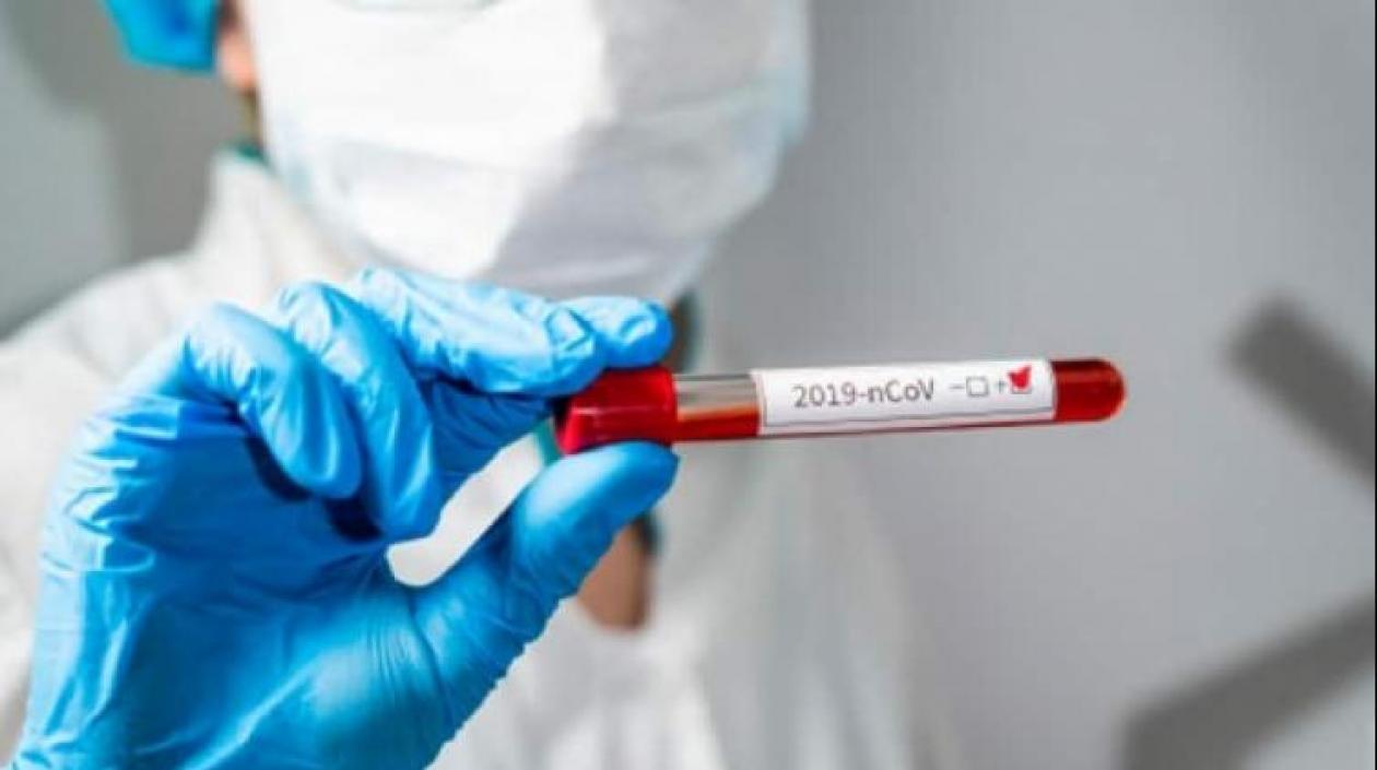 Autoridades piden a la ciudadanía mantener el distanciamiento social, el uso del tapabocas y el lavado de manos. 