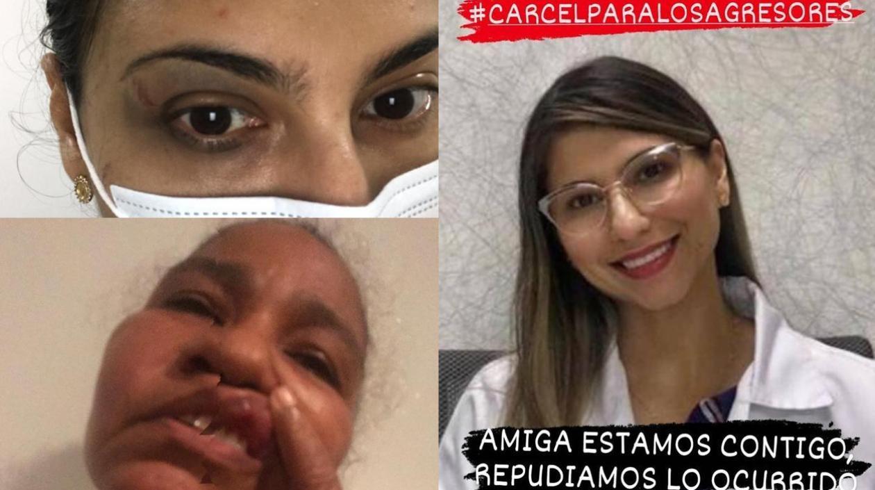 La pediatra Dalila Peñaranda y la empleada, mostrando los efectos de las agresiones.