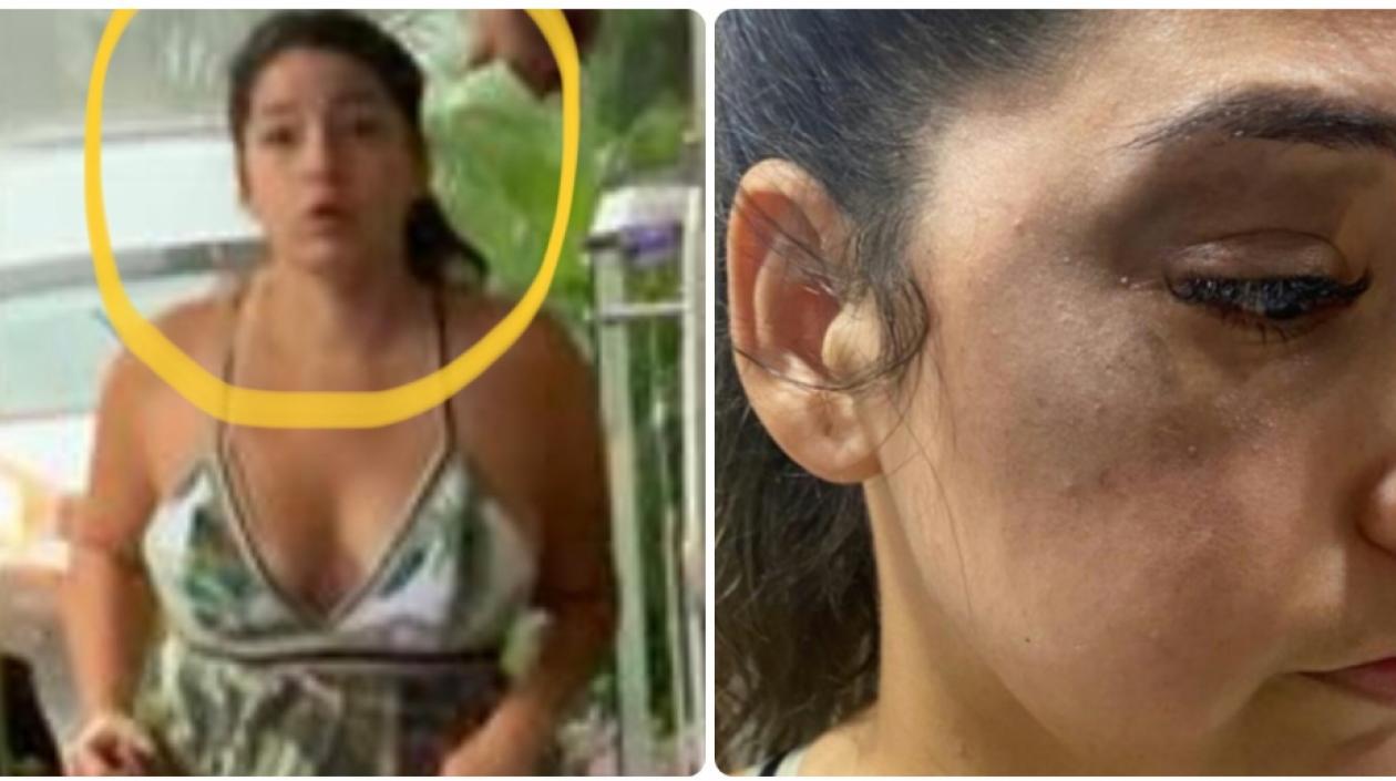 Mujer dice que tiene moretones porque le pegaron primero.