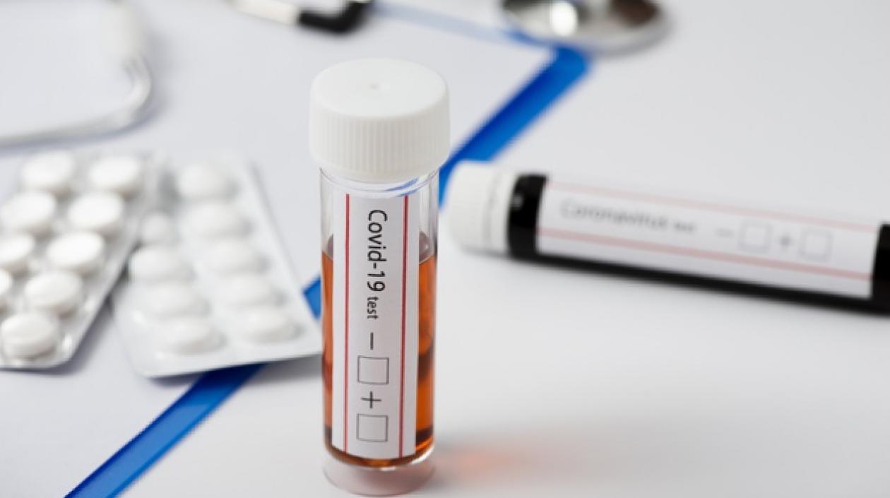 Valores financian todo el proceso desde toma de muestra hasta entrega de resultados de pruebas Covid-19.