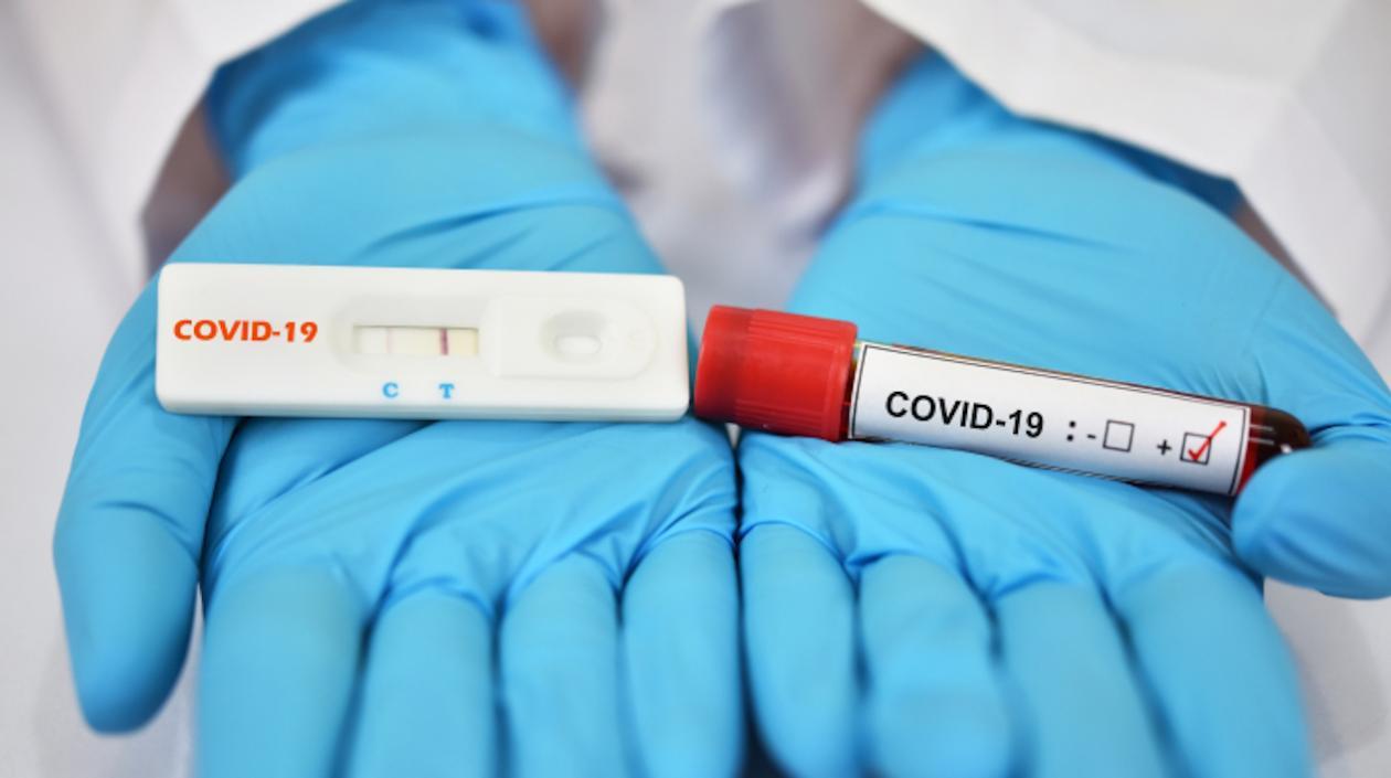 Con los 179 muertes de hoy el país superó los 25 mil decesos.