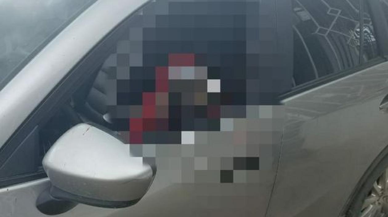 Jhon Fredy Amador Miranda, tras el ataque a bala.