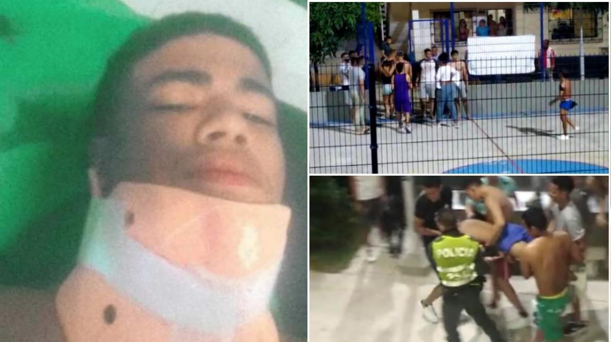 Lucas Daniel Fontalvo Rodríguez, el joven que recibió un fuerte batazo en una riña.