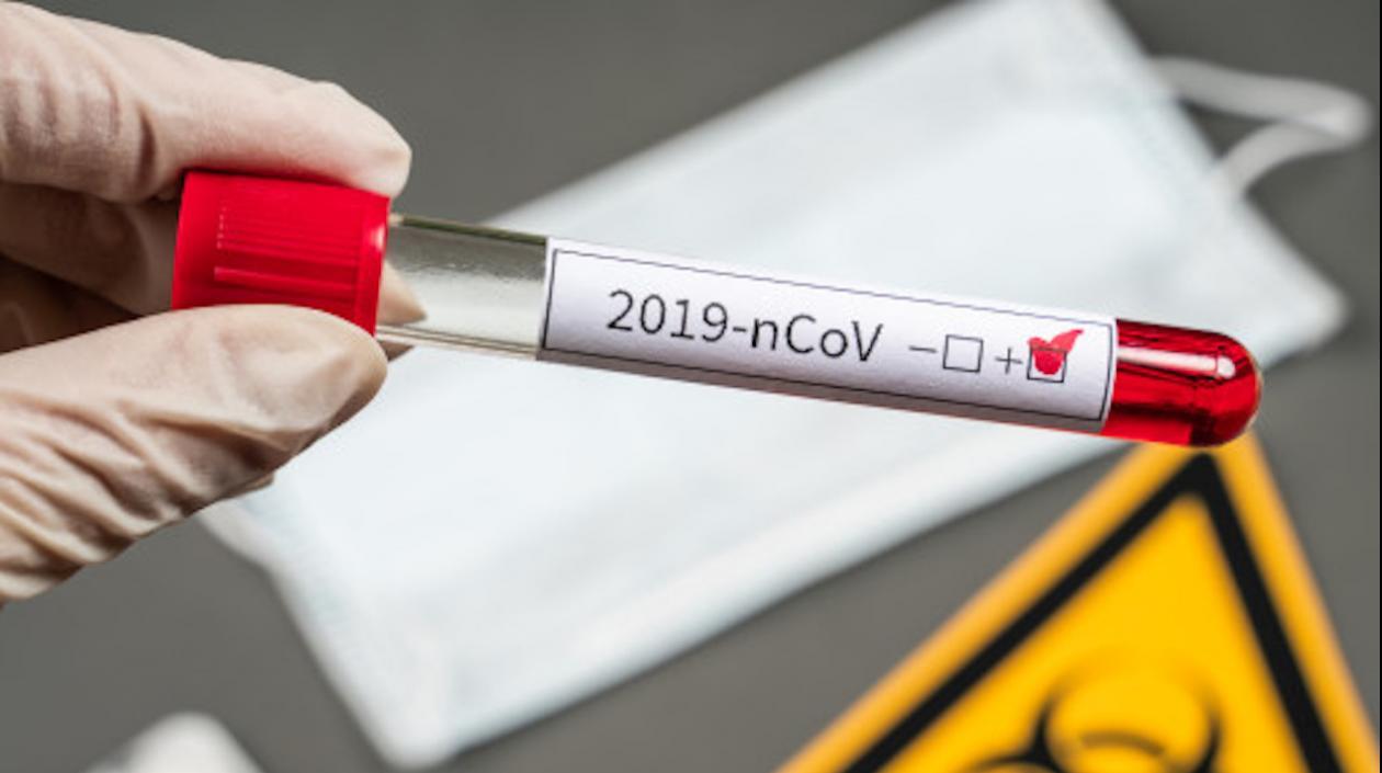 Los casos de Covid-19 en Colombia siguen en aumento.