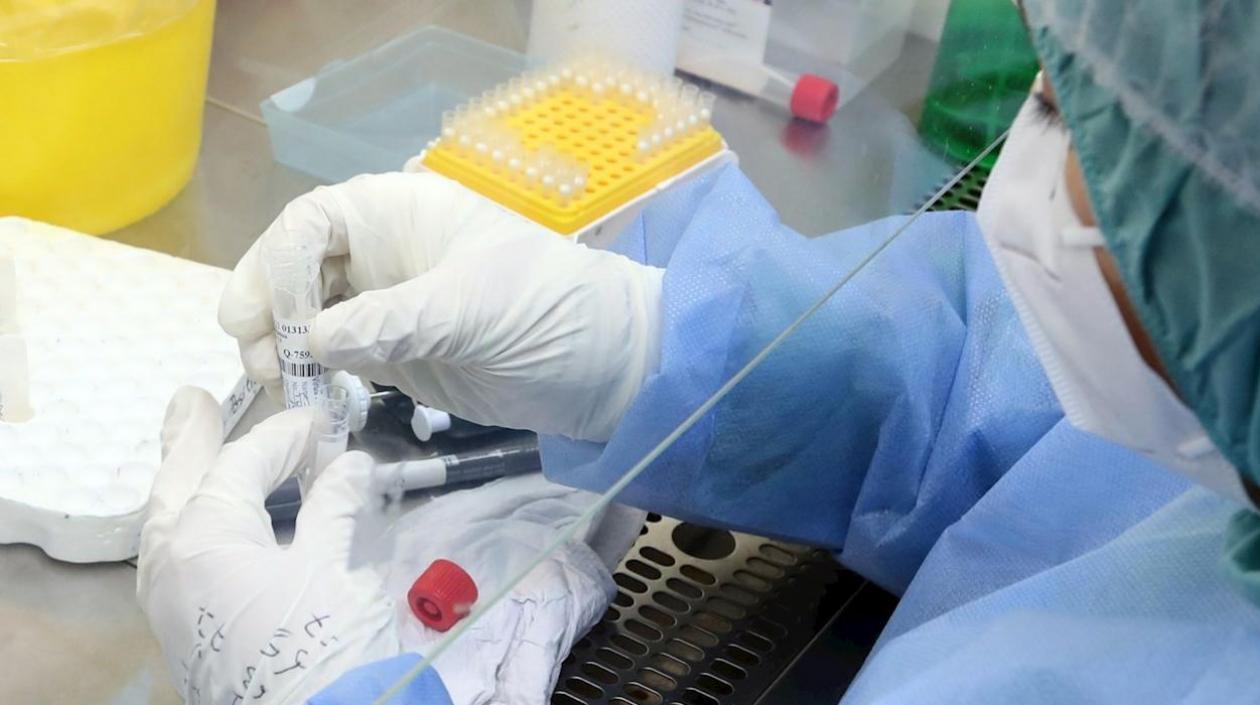 Los casos nuevos de Covid-19 en Colombia fueron 1.189.