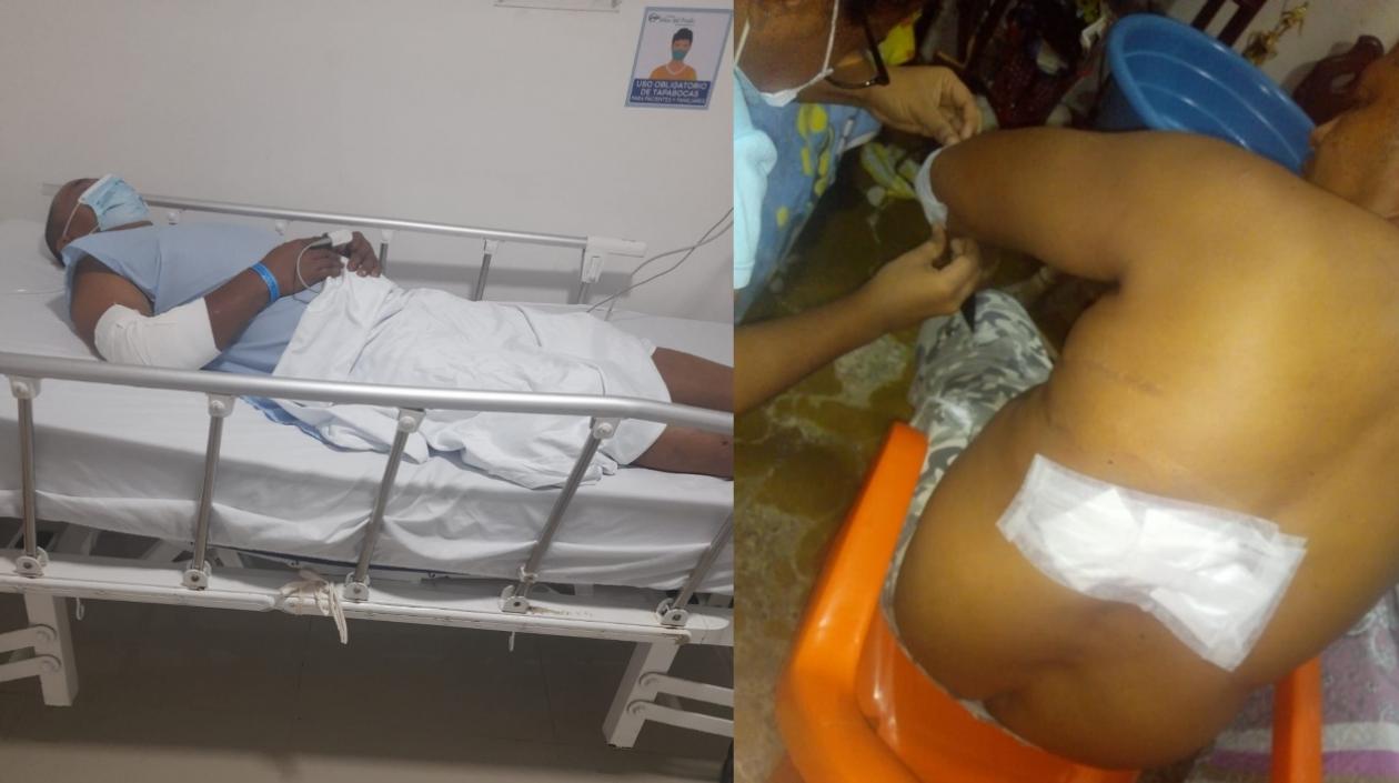 Edinson Padilla y Héctor Meza, los arrollados.