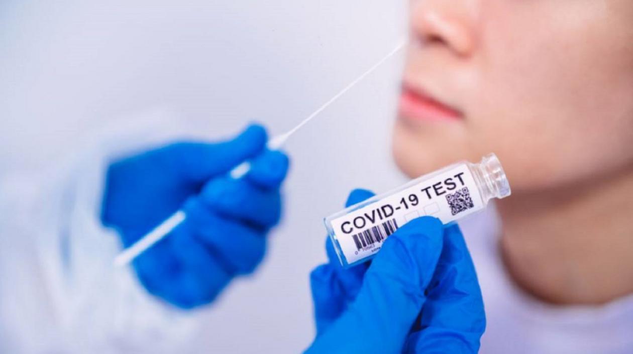 Pruebas disminuyeron igual que los casos reportados.